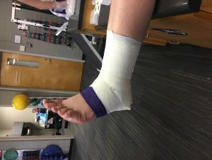 Taping an Ankle Taping an Ankle